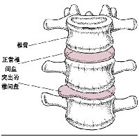 河南省工人龙门疗养院疼痛科|洛阳疼痛专科|专业治疗颈肩腰腿痛