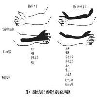 得了颈椎病怎么办？省工疗疼痛科技术硬疗效好图1