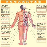 腰腿疼痛到哪里？洛阳疼痛专科首选省工疗疼痛科图1