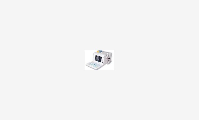 数字化超声诊断仪