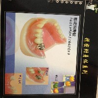 市南哪家牙科诊所专业 市南牙科诊所推荐【首选】 圣迪安图1