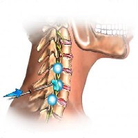 颈肩腰腿疼痛到哪里？就到省工疗疼痛科专业治疗